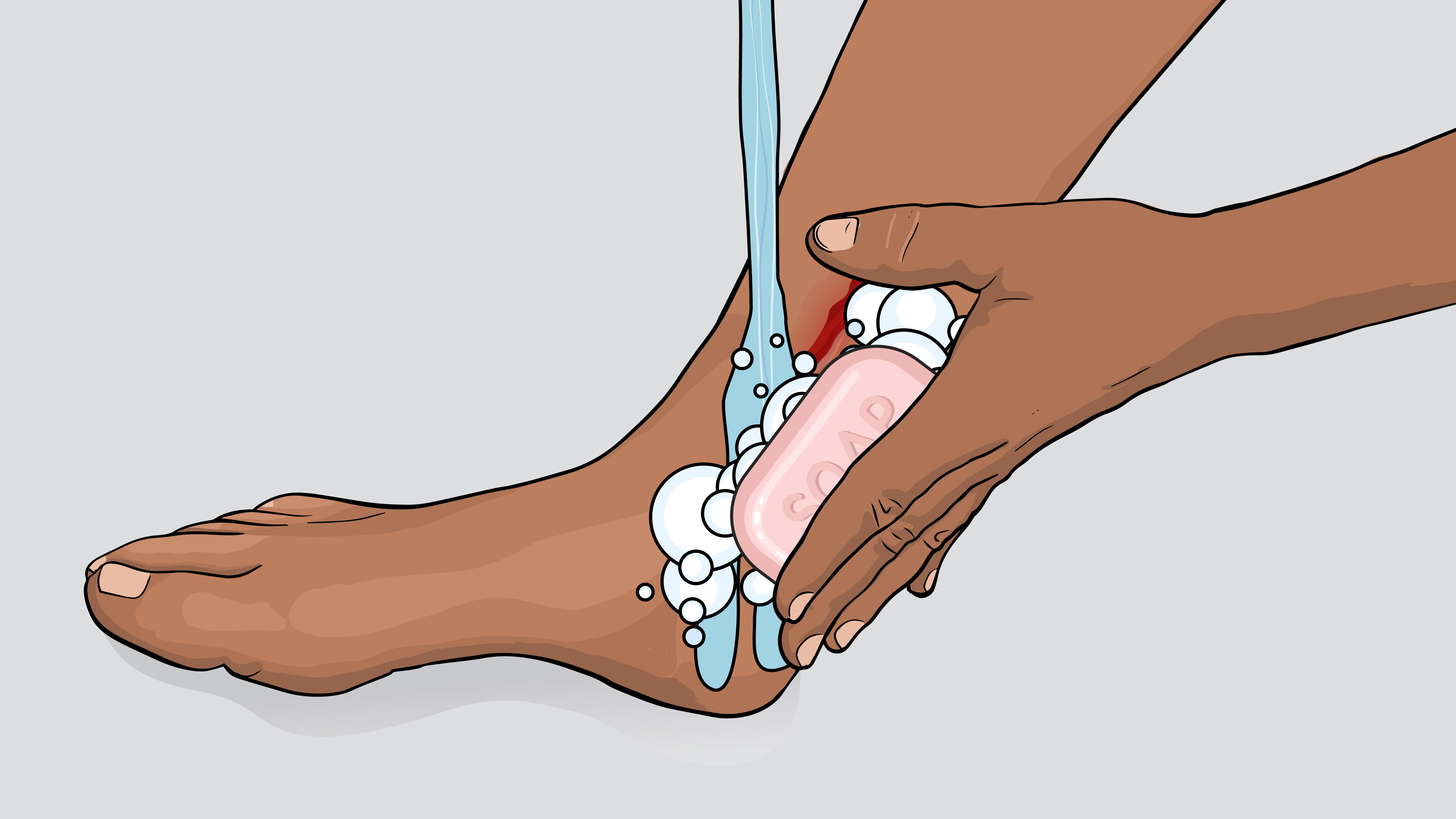 Illustration of a person cleaning an open wound on their leg by washing it with soap and water.