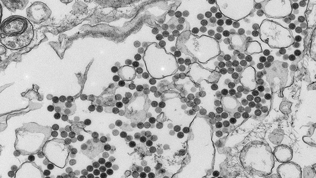 Electron microscopic image of the Heartland virus.