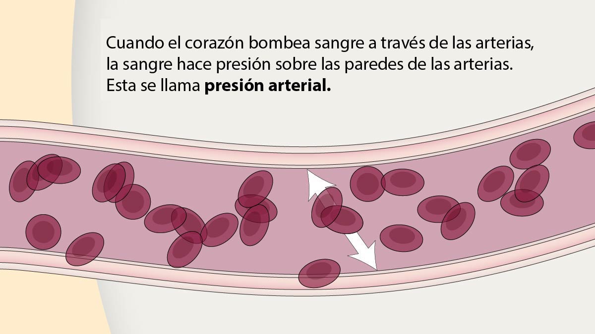 Cuando el corazón bombea sangre a través de las arterias, la sangre hace presión sobre las paredes de las arterias. Esta se llama presión arterial.