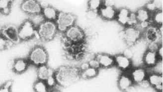 Electron microscopic image of the La Crosse virus.