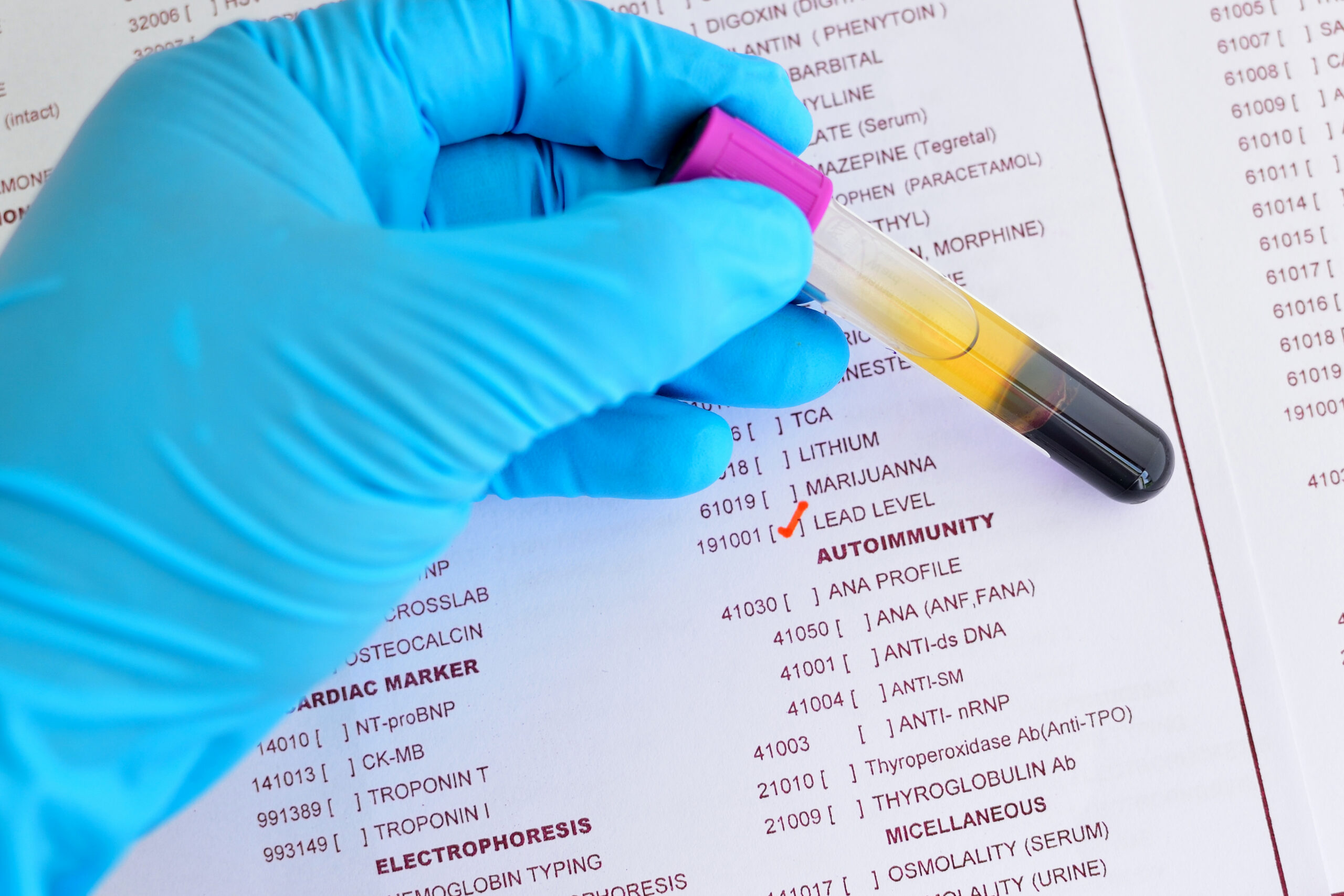 Image of gloved hand holding a test tube over a handout with lead checked off