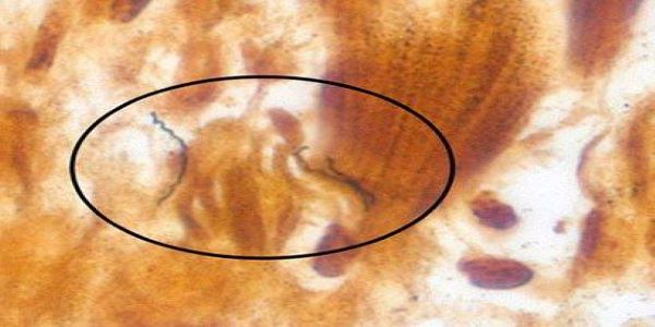 Spirochetes in heart tissue. Image taken using Warthin-Starry stain at 158X magnification.