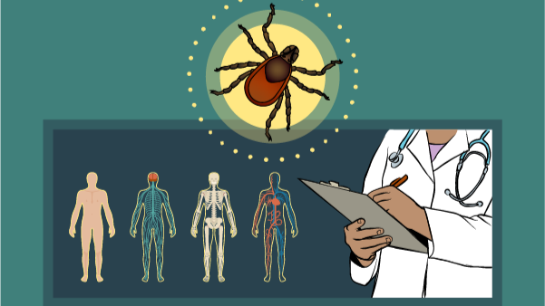 Illustration of a healthcare provider learning how to diagnose and treat Lyme disease.
