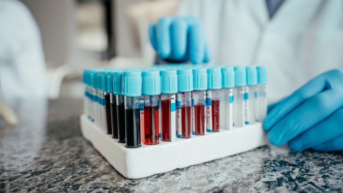A HCP holds a blood tube collection in a rack.
