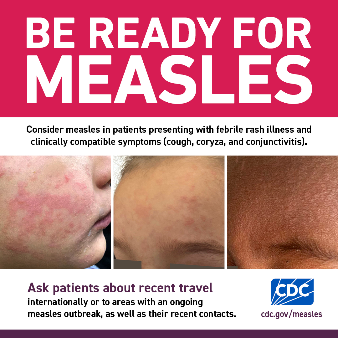 Be Ready For Measles (1080x1080) | 3 Images
