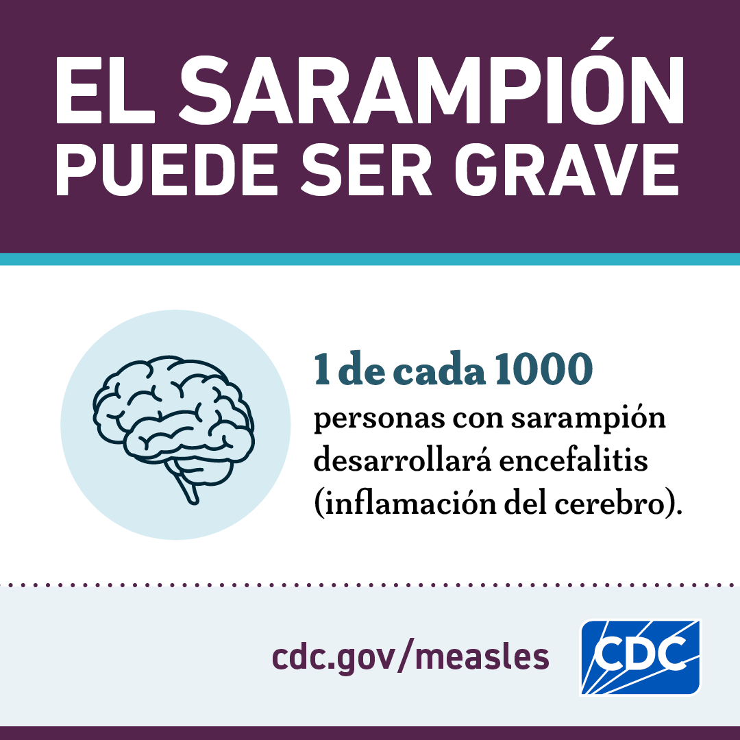 Measles can be serious - graphic 2 (Spanish)