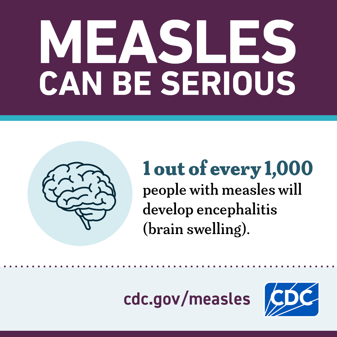 Measles can be serious - graphic 2