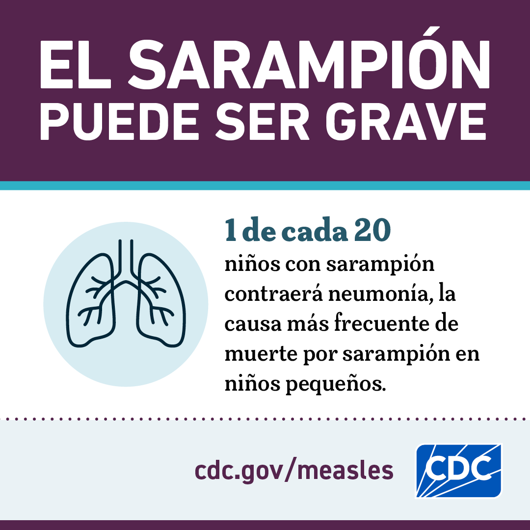Measles can be serious - graphic 3