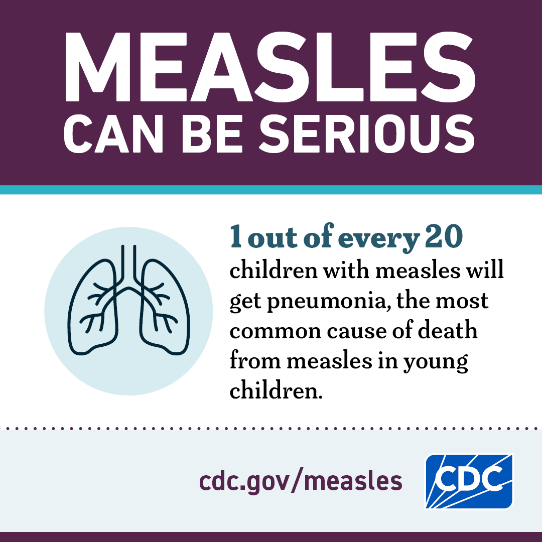 Measles can be serious - graphic 3
