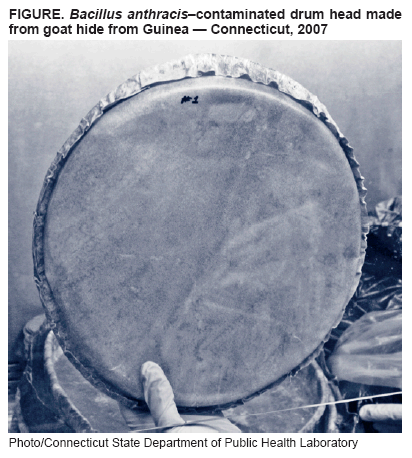 FIGURE. Bacillus anthracis�contaminated drum head made from goat hide from Guinea � Connecticut, 2007