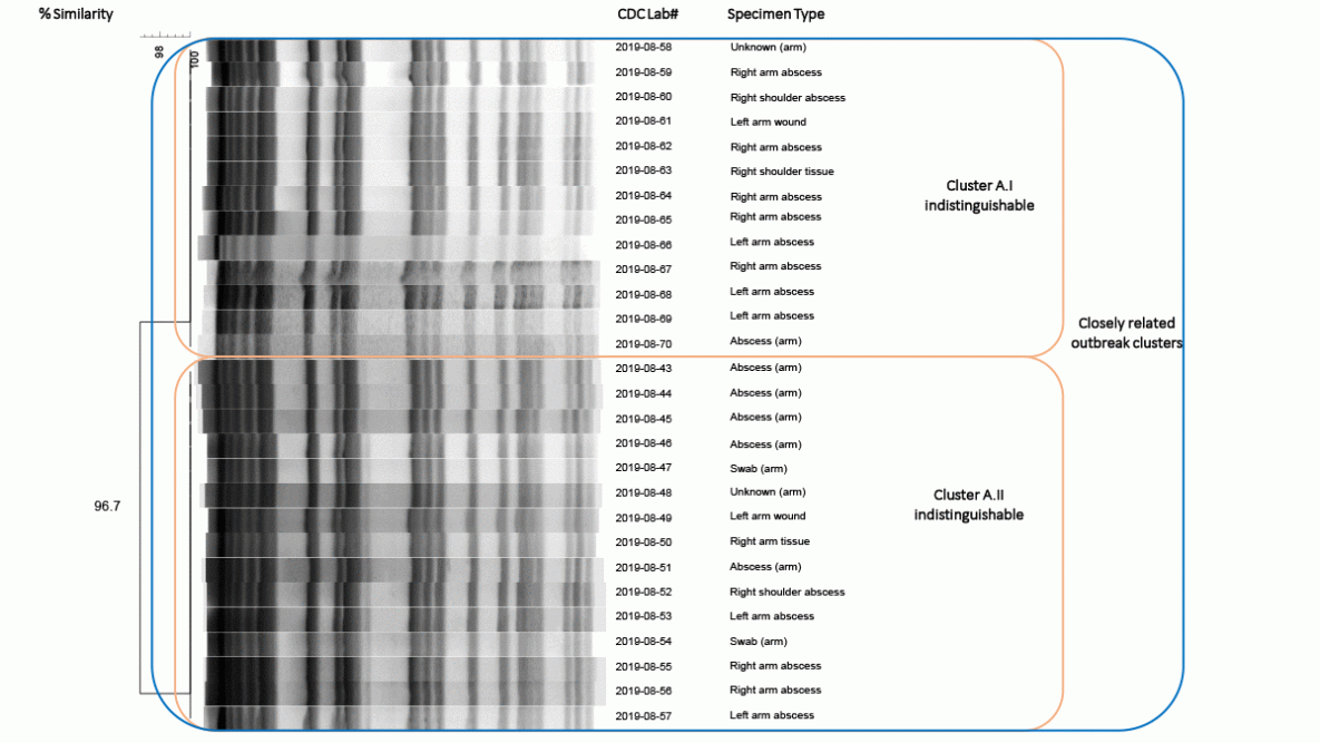 Figure is a pulsed-field gel electrophoresis dendrogram of 28 Mycobacterium porcinum specimens isolated from patients vaccinated by company A in Kentucky and Ohio during September 2018&ndash;February 2019.
