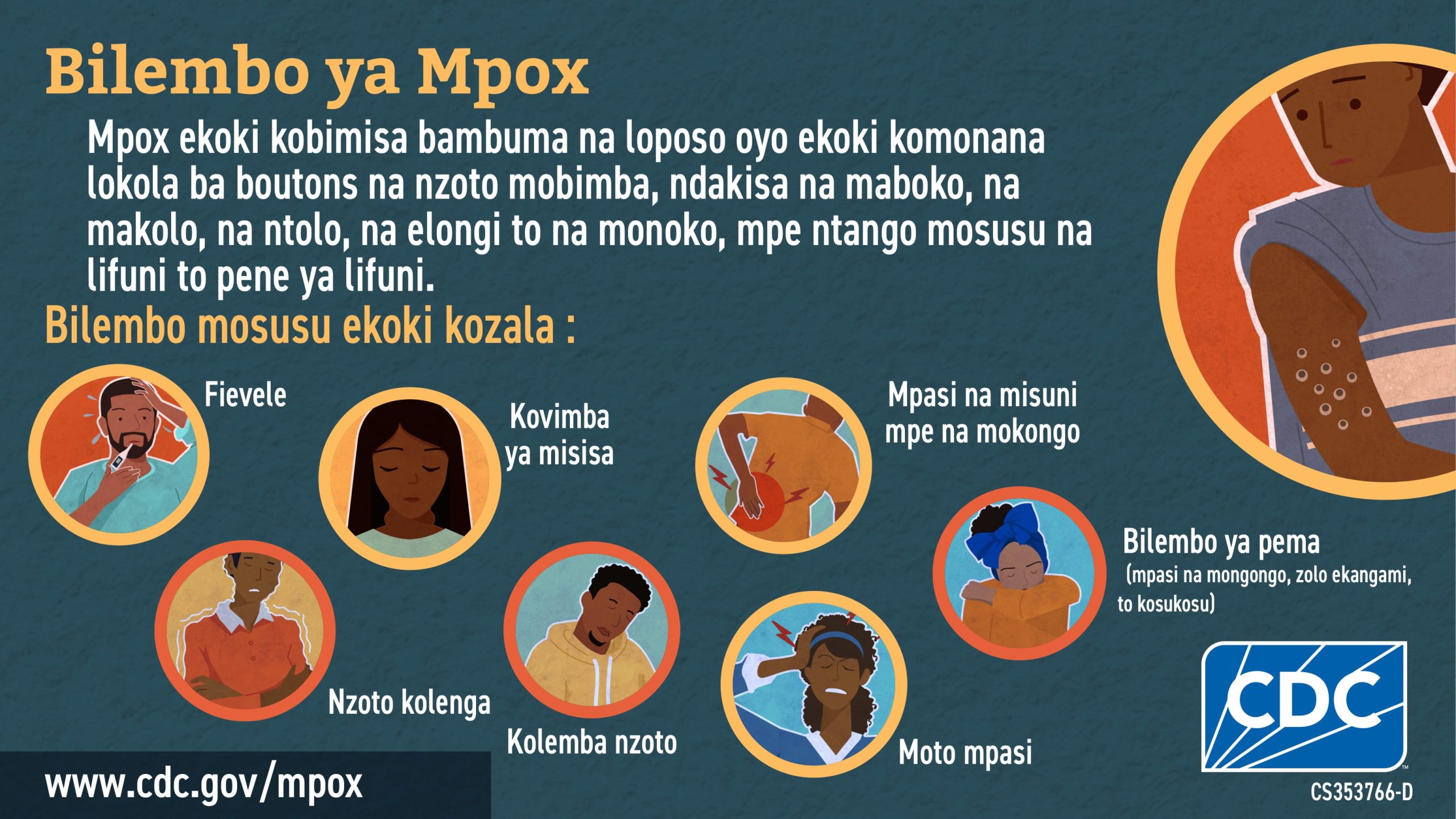 (In Lingala) Bilembo ya Monkeypox