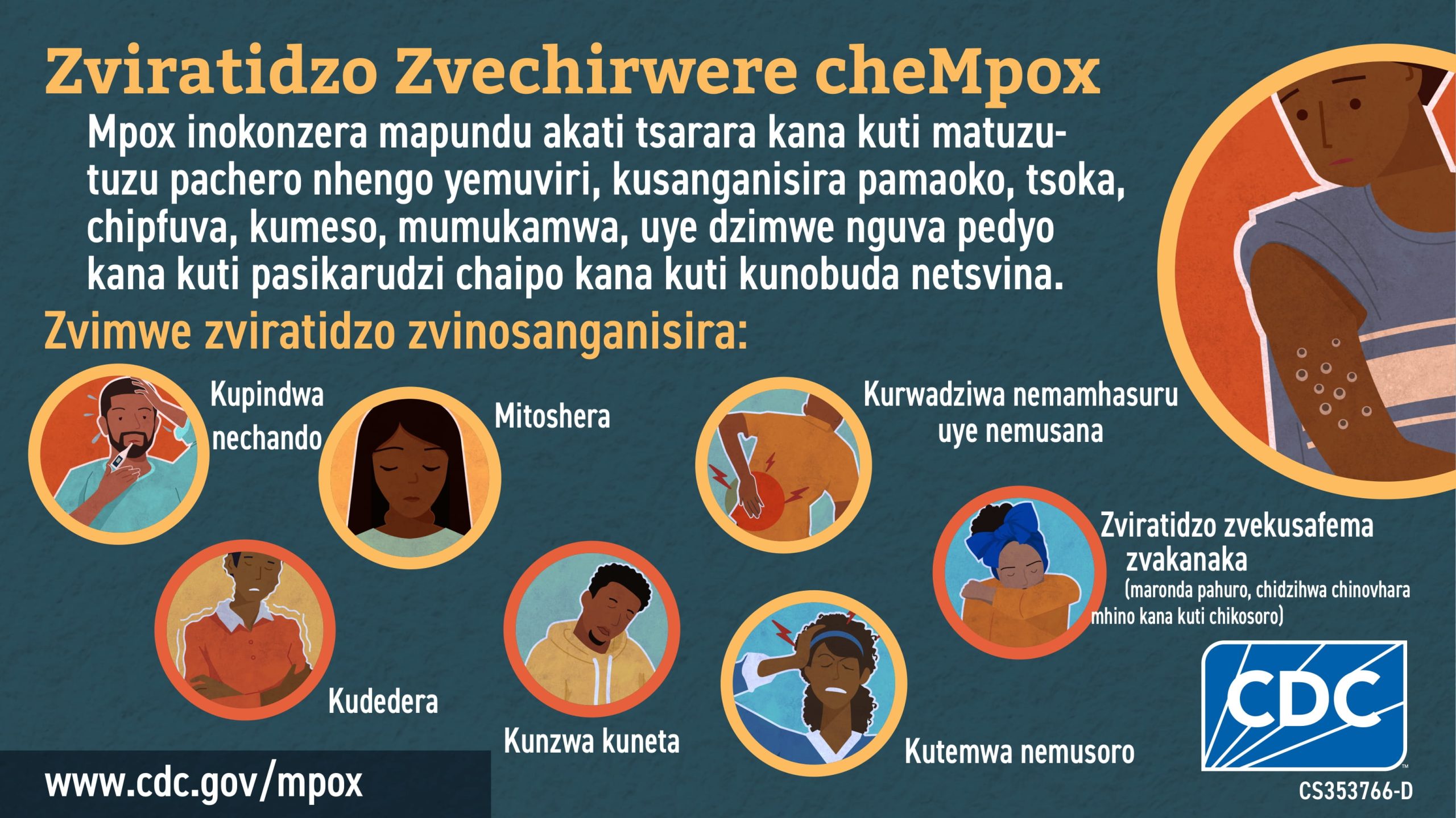 (In Shona) Zviratidzo Zvechirwere cheMpox