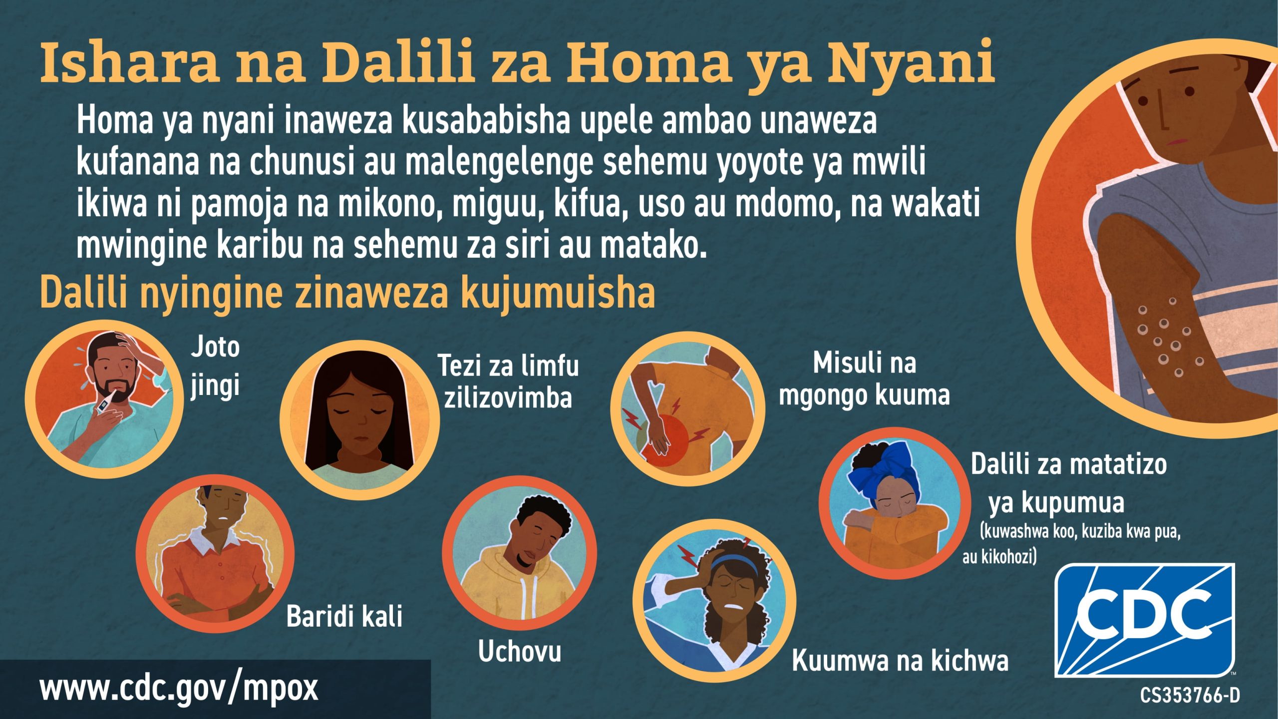(In Swahili) Ishara na Dalili za Homa ya Nyani