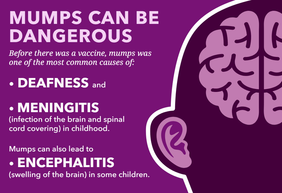 Infographic: Mumps. More than just swollen glands.