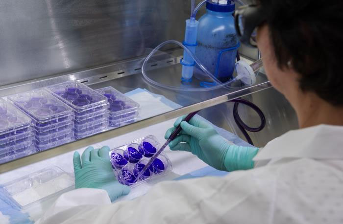 intro03 CDC scientist was shown performing a virus plaque assay,