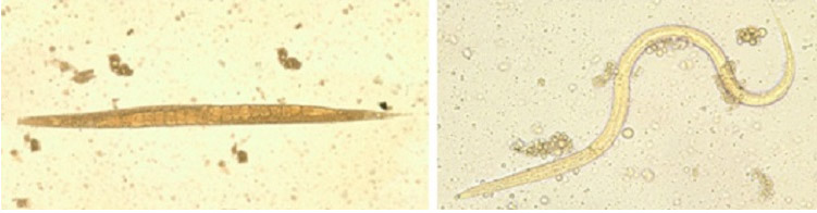 phapproach01 Two images of parasites. On the left is an adult free-living female S. stercoralis. Two rows of eggs are visisble within the female’s body. On the right is a Filariform (L3) larva of S. stercoralis in an unstained wet mount.