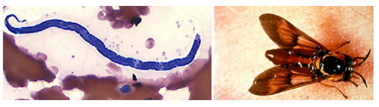 phapproach02 Two images of parasites. On the left microfilaria of L. loa is shown in a thin blood smear, stained with Giemsa. On the right is an image of Chrysops silacea deerfly feeding on a human hand.