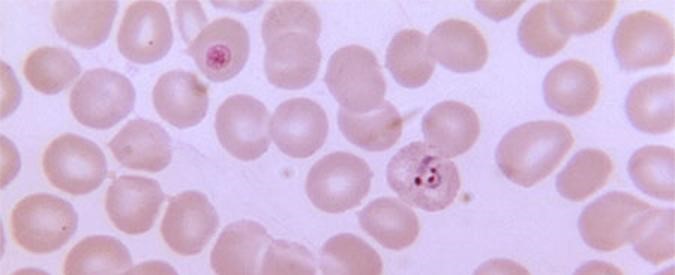 malaria-cells Photo of malaria cells under a microscope