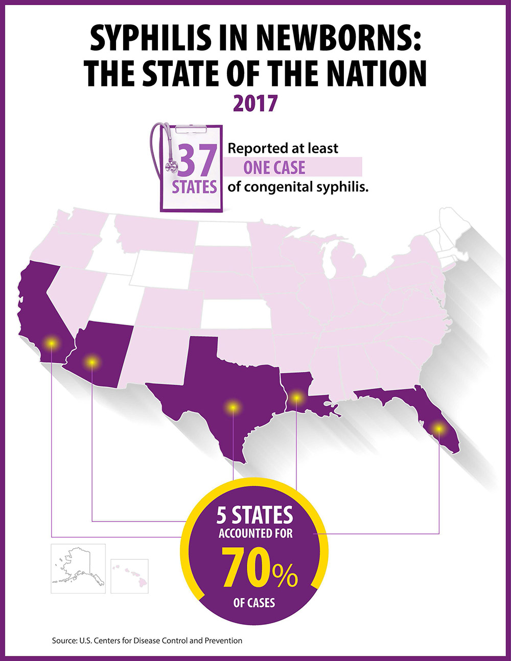 SYPHILIS IN NEWBORNS: THE STATE OF THE NATION2017