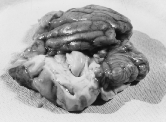 Black-and-white photo of a dissected dog brain displaying inflammation and swelling, two hallmarks of meningitis. Blood vessels and ridges on the brain are visible.&rdquo;