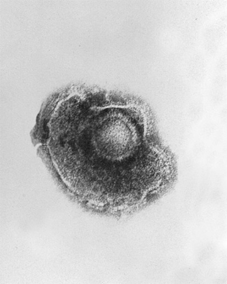Chickenpox Chickenpox under microscope