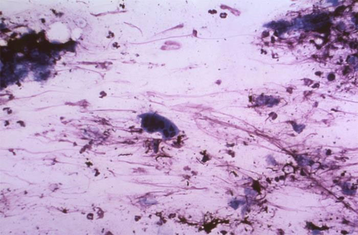 Varicella-zoster virus Varicella-zoster virus under microscope