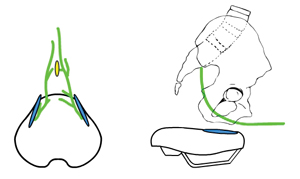 No-nose Saddles for Preventing Genital Numbness and Sexual Dysfunction from Occupational Bicycling