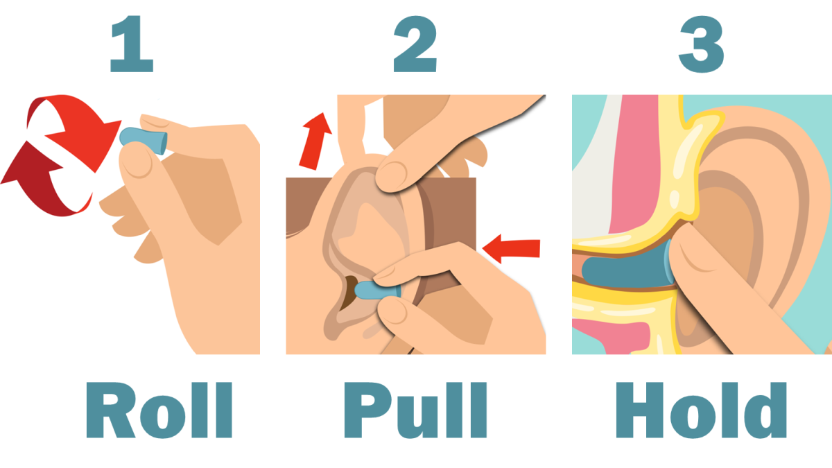Thumbnail image of Roll-Pull-Hold earplug technique
