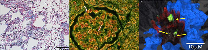 Photos of nanoparticles