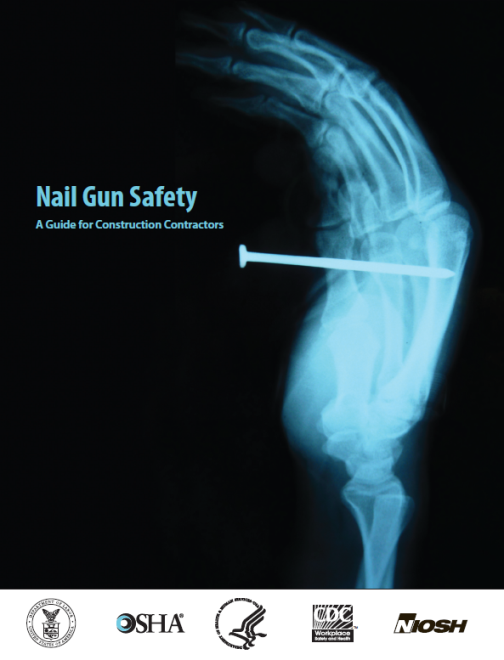 x-ray of nail in a hand