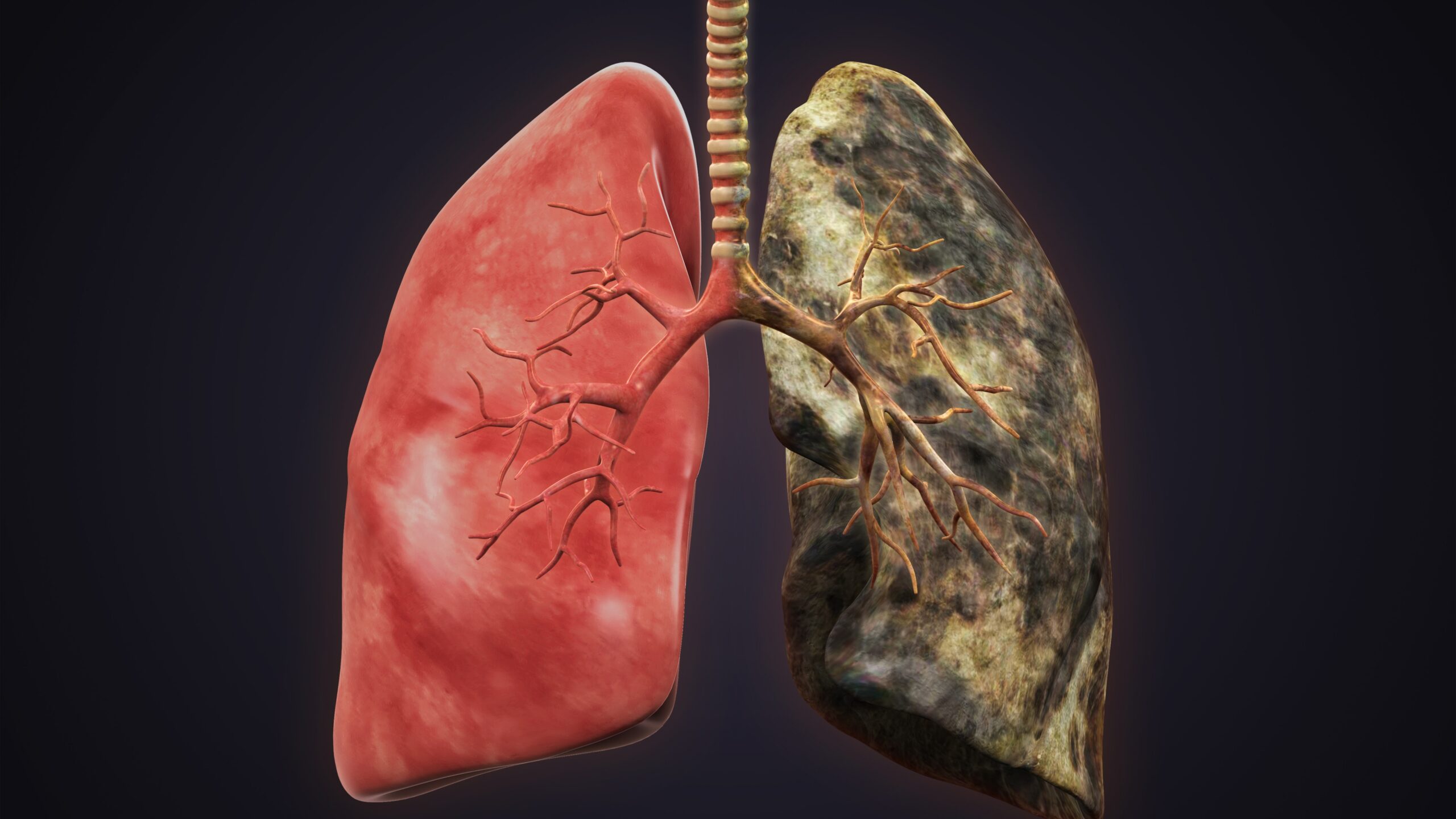 A healthy left lung and a black right lung