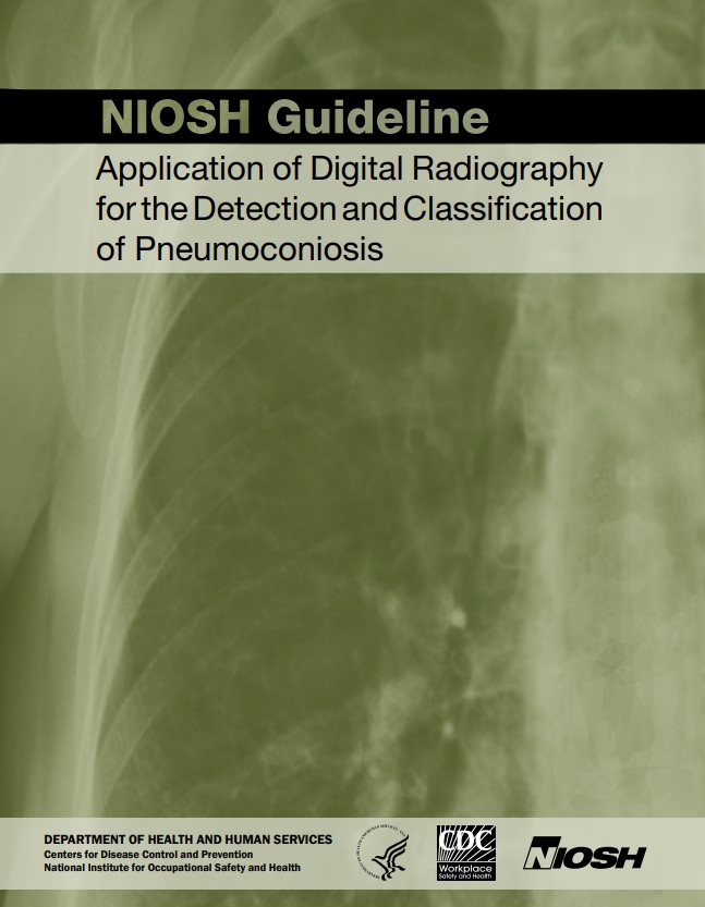 NIOSH Guideline: Application of Digital Radiography for the Detection and Classification of Pneumoconiosis