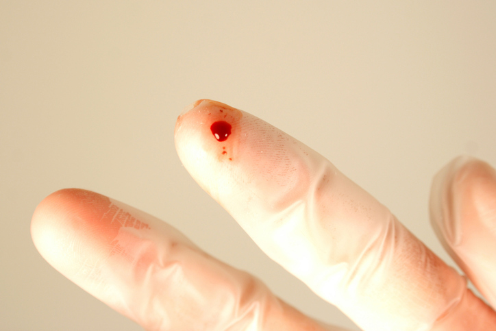 needlestickinjury.jpg Hand wearing surgical glove with a finger prick and blood.
