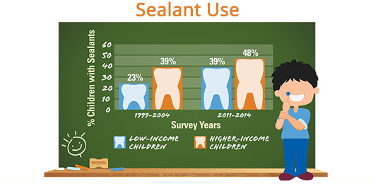 Sealant Use Sealant Use