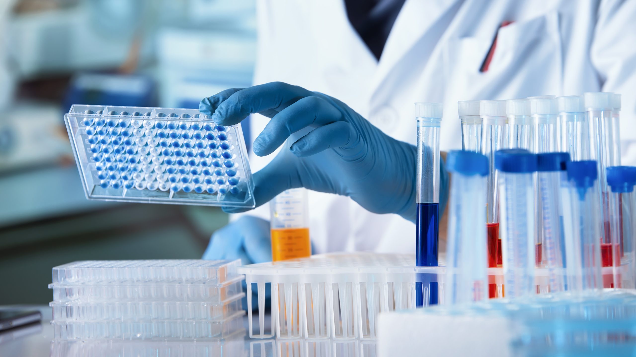 A laboratory worker holds a PCR test.
