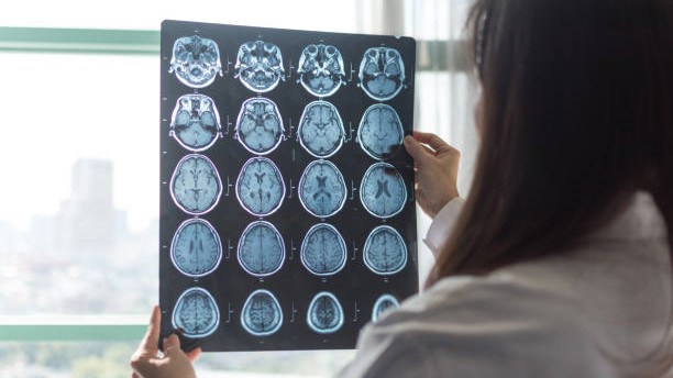 A female doctor looks at a brain imaging sheet.