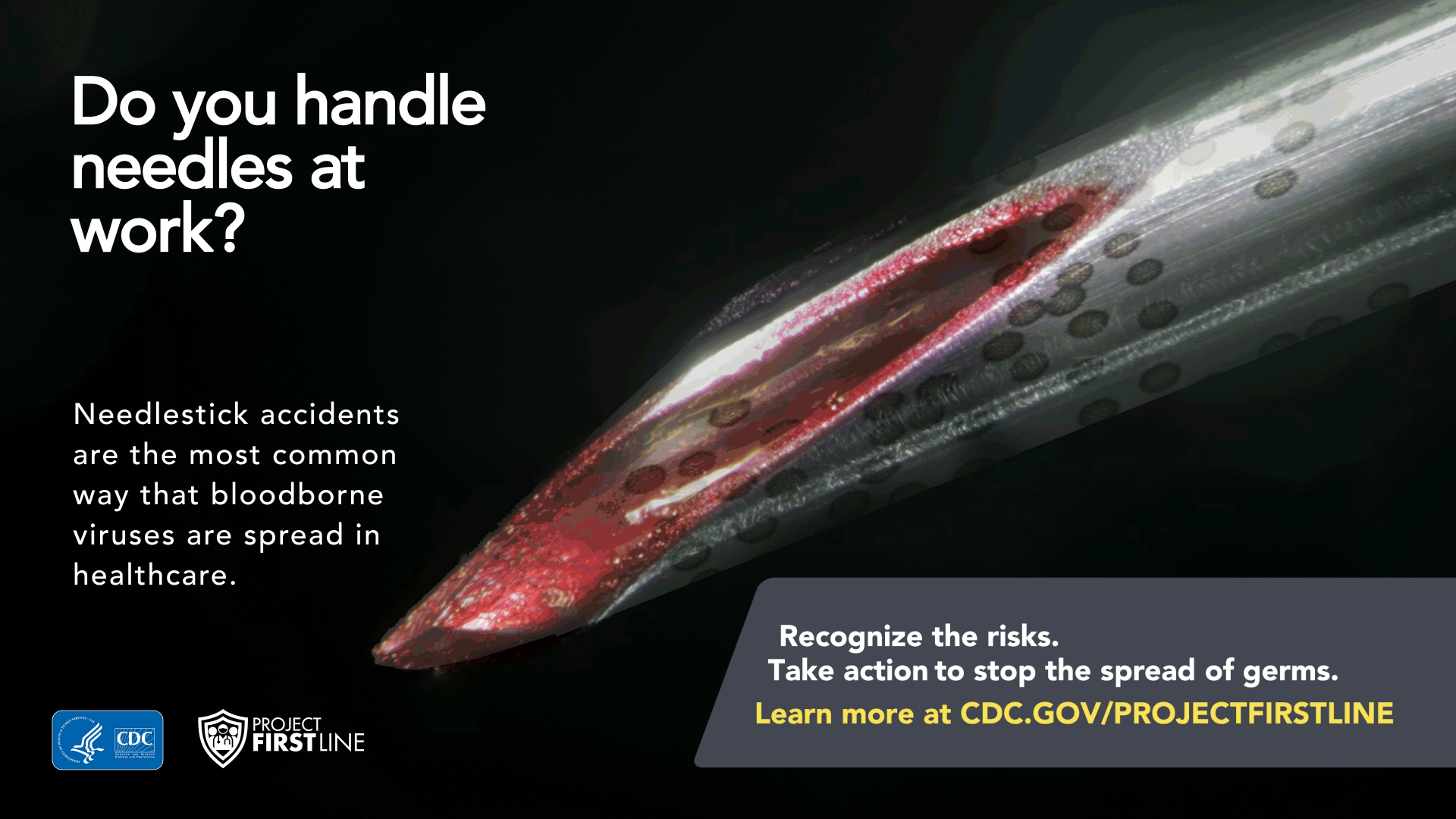 Needlestick accidents are the most common way that bloodborne viruses are spread in healthcare.