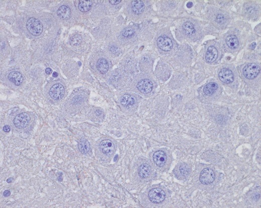Blue stain shows the absence of rabies virus antigen during testing