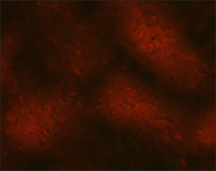 Dark red splotches on a black background