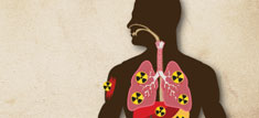 Internal Contamination Graphic image 7 KB Graphic depicting radiation contamination within the body