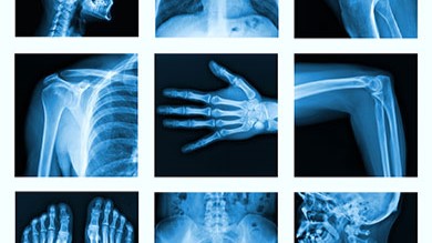 Several x-rays of a skull, ribs, joints, feet, and a pelvis.