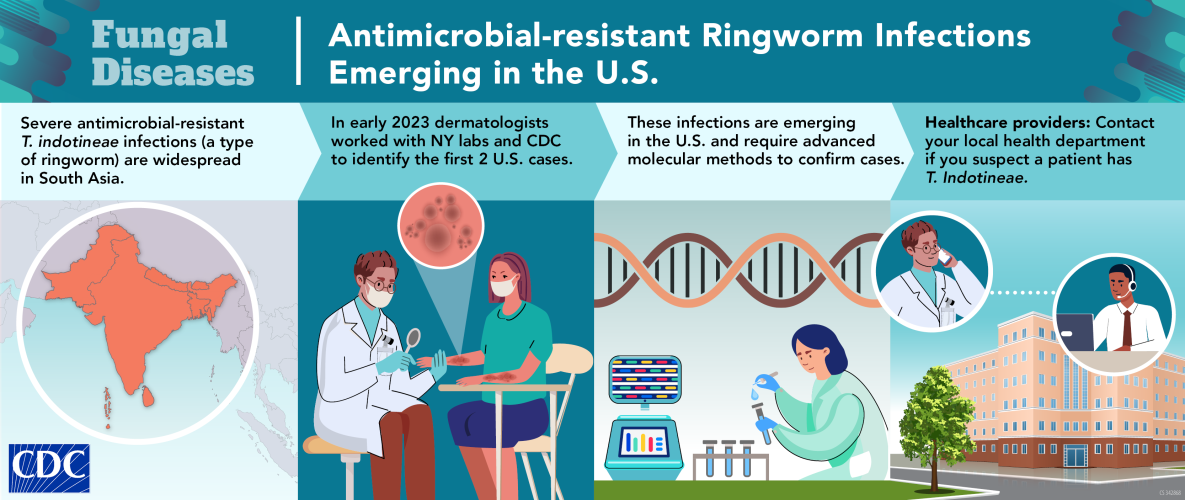 In early 2023 the first two U.S. cases of antimicrobial-resistant T. indotineae were identified.