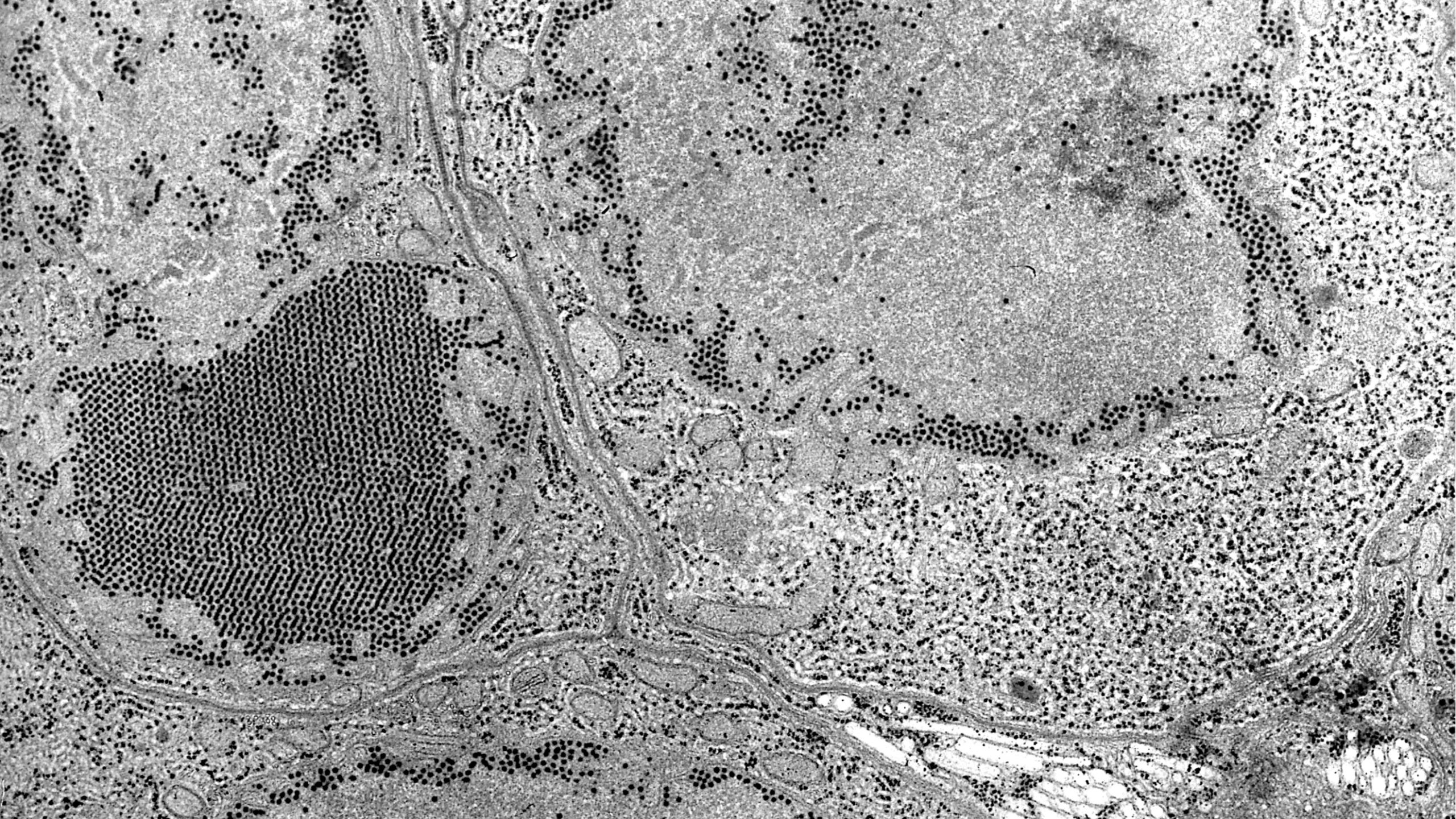 Electron microscopic image of St. Louis encephalitis virus.