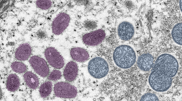 Imagen microsc&oacute;pica en colores de la viruela del mono