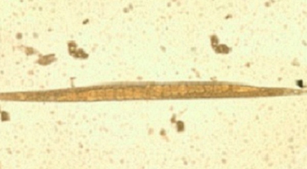 — title missing — Adult free-living female S. stercoralis.