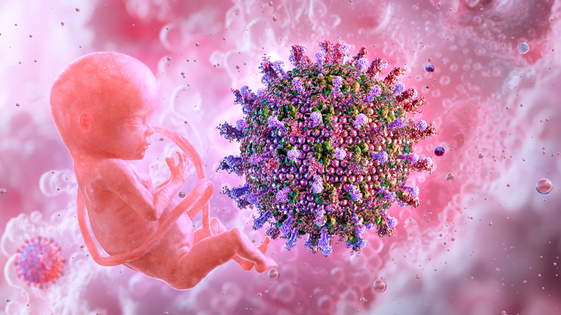 Congenital Rubella illustration