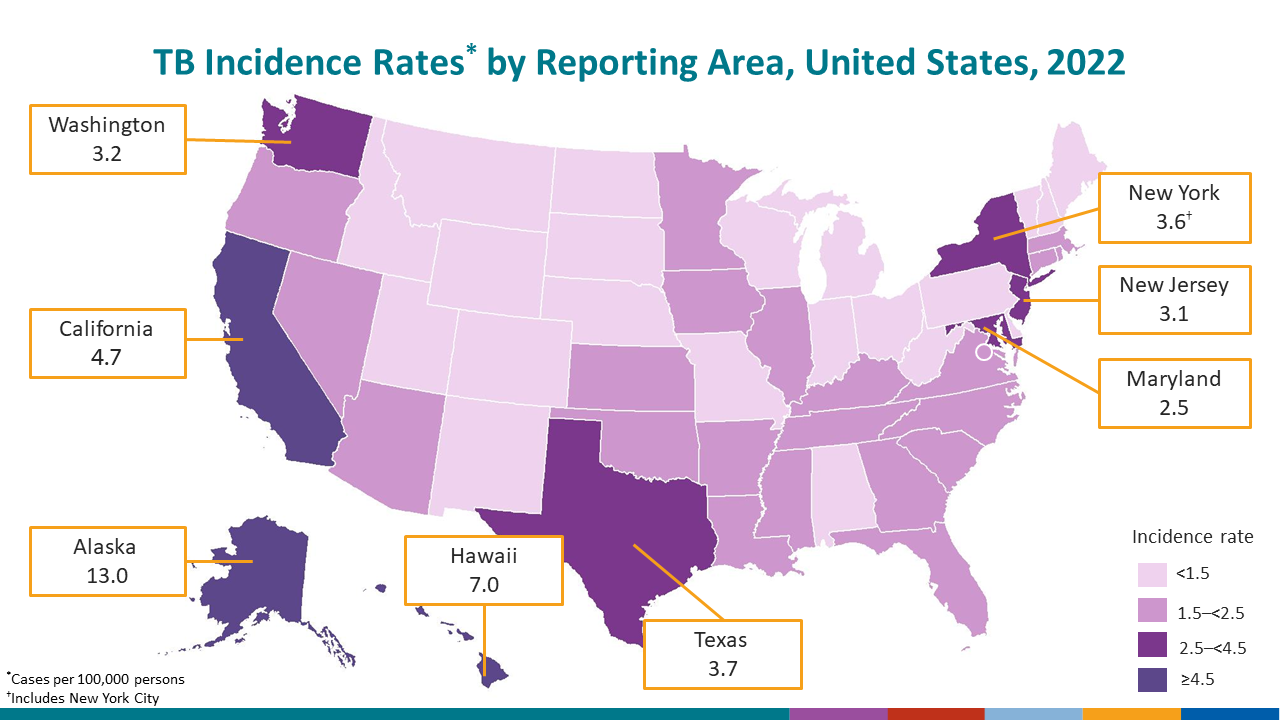 Majority of TB Cases Occur in Four States, United States, 2020