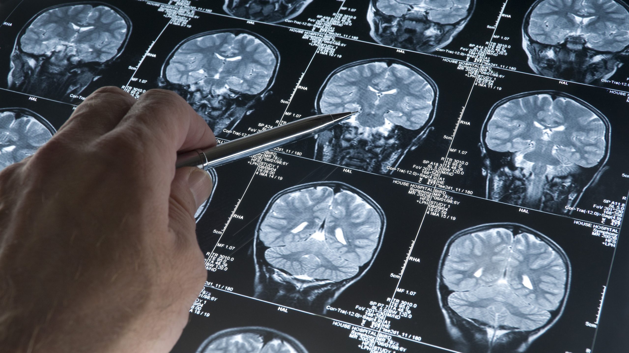 A specialist reviews a brain imaging scan sheet.