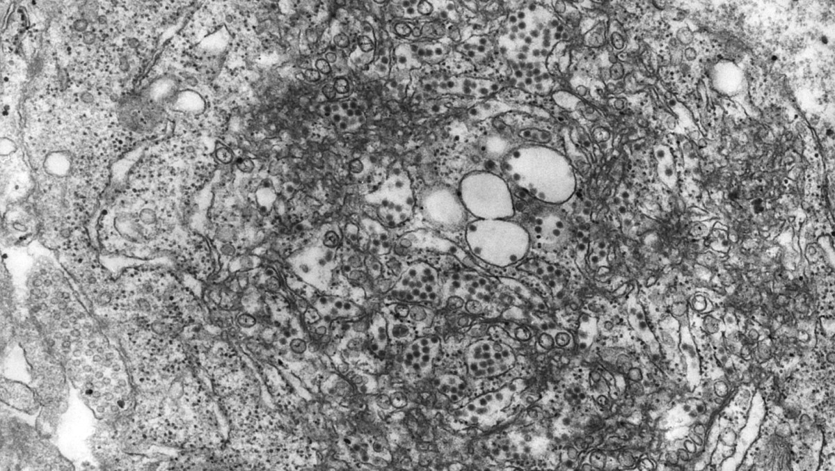 Transmission electron microscopic image of tick-borne encephalitis virus.